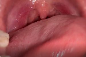 nana粉嫩口腔展示（24.09.09~3）